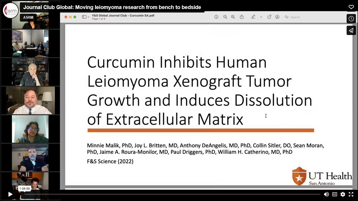 JOURNAL CLUB GLOBAL: MOVING LEIOMYOMA RESEARCH FROM BENCH TO BEDSIDE teaser