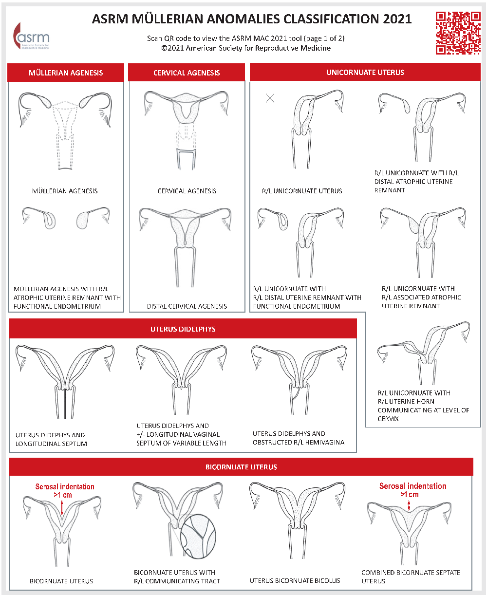 Fig1-asrm-mullerian-anomalies.png