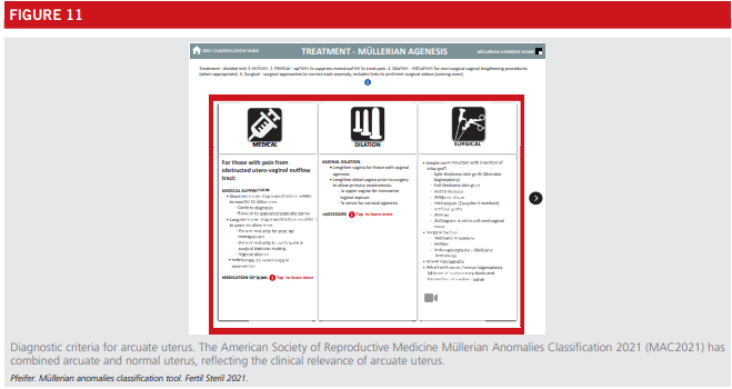 Fig11-asrm-mullerian-anomalies.png