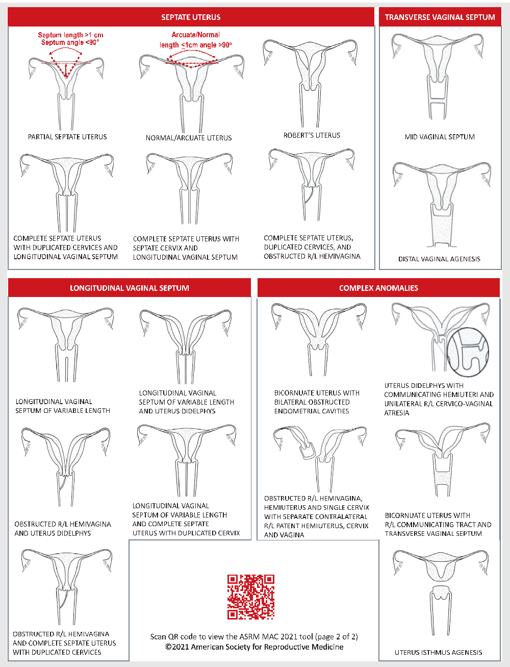 Fig1b-asrm-mullerian-anomalies.png