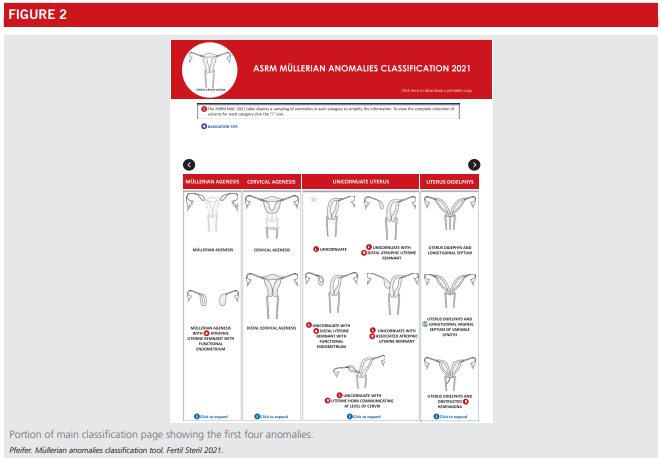 Fig2-asrm-mullerian-anomalies.png