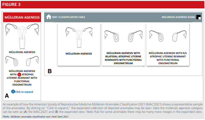 Fig3-asrm-mullerian-anomalies.png