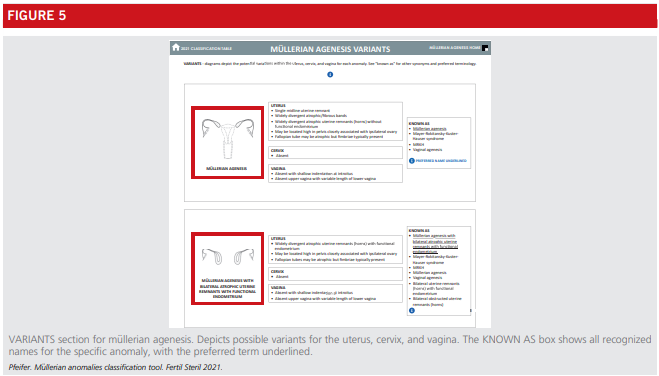 Fig5-asrm-mullerian-anomalies.png