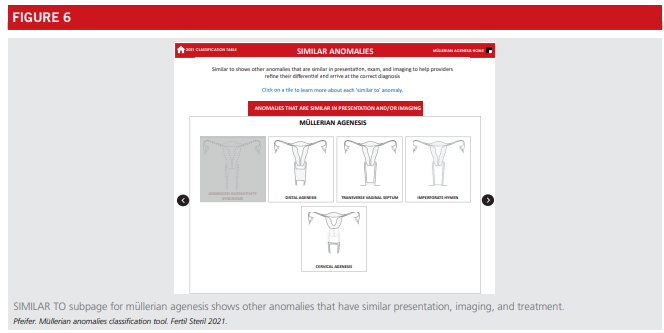 Fig6-asrm-mullerian-anomalies.png