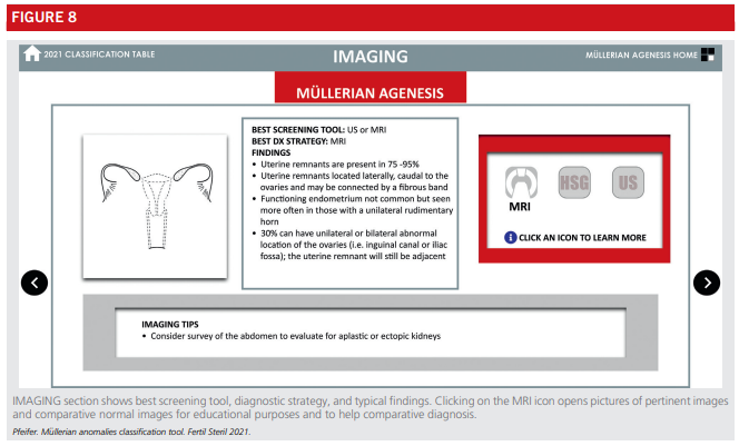 Fig8-asrm-mullerian-anomalies.png