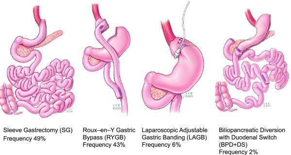 Obesity-FIg2-obesity.jpeg